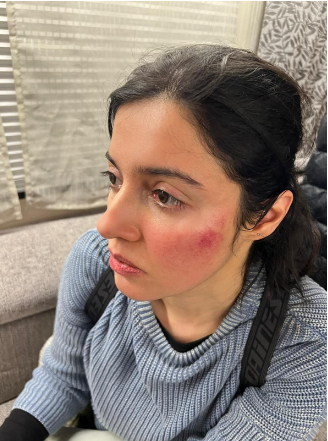 Divya Khosla Kumar's Determination and Dedication: Pushing Through an Injury to Complete Her Upcoming Project